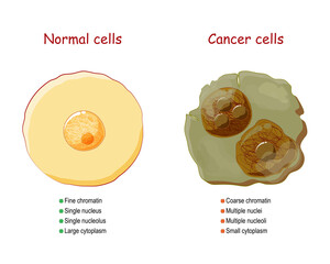 Cancer and normal cells. comparison and difference