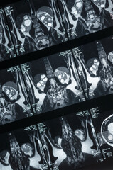 Bild einer Magnetresonaztomographie, MRT,  Computertomographie, Röntgenbild.
Bereich des Becken...