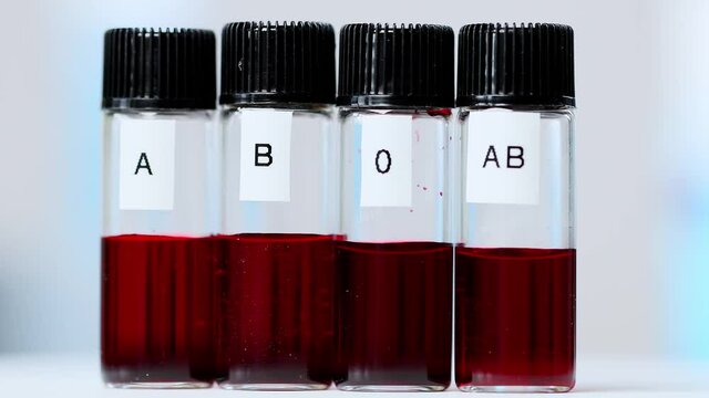 the four blood groups in test tubes
