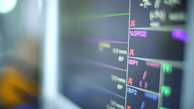 Heart EKG monitor. Emergency medical service.