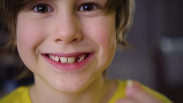 The boy's milk tooth fell out. A satisfied child holds a tooth in his hand. A hole in the gum is visible