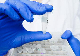 hands of scientist holds test tube with DNA patient sample. research technician with test sample box in genetic laboratory. genetic and cancer screening, medical technology and therapy.