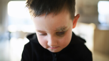 Poor sad small boy with cut eyebrow standing indoors at home, poverty concept.