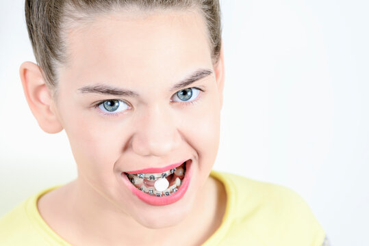 Girl holds in teeth with braces. White tablet. Concept of dentistry and installation of braces.
