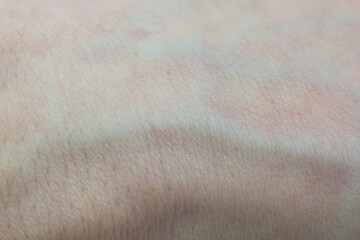 Fototapeta premium Human skin with hairs texture background. Macro photo, close up. Soft focus.