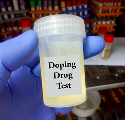Urine sample for doping drug test