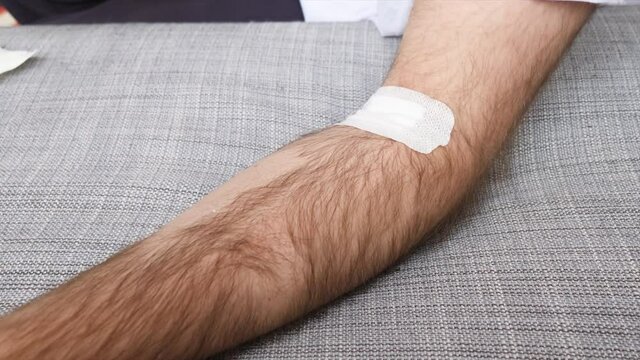 Male hand removing from the hairy hand the glued non-skin-friendly adhesive non-woven dressing after a chemotherapy - time-lapse 4k UHD footage
