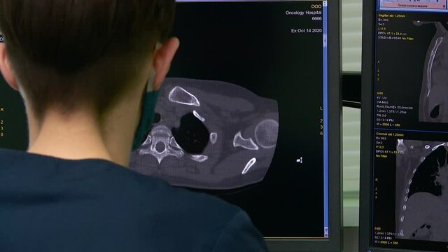 the study of a cancer patient on a tomograph