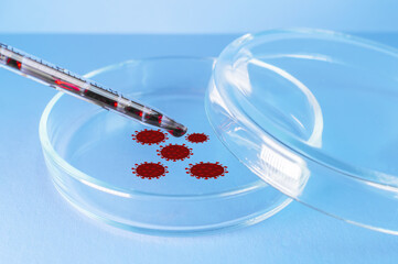 Medical laboratory. The virus-infected blood from the pipette is poured into a Petri dish on a blue...