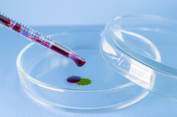Medical laboratory. The virus-infected blood from the pipette is poured into a Petri dish on a blue...