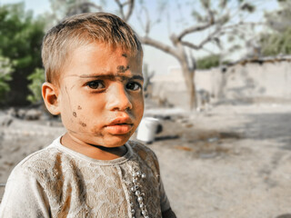 closeup of a poor staring hungry orphan boy in a refugee camp with sad expression on his face and...
