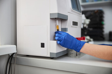 Biochemist using a hematology analyzer for conducting a hematological test