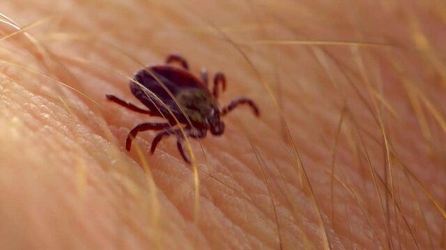 Macro Video of Encephalitis Tick Insect Crawling on Human Skin. Encephalitis Virus or Lyme Borreliosis Disease Infectious Dermacentor Tick Arachnid Parasite.