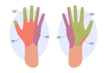 ulnar nerve muscle bone elbow swollen pain hand palm bone spurs ring little medial golfer radial arms wrist funny carpal tennis canal palsy test