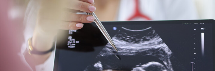 Doctor shows pregnant woman an ultrasound scan of fetus.