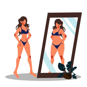 Woman body reflection of obesity in the mirror anorexia cartoon flat lifestyle vector illustration