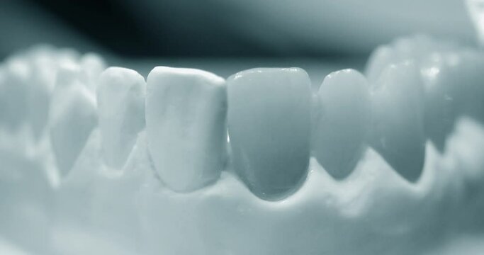 Model of human teeth with artificial teeth close-up