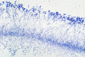 Penicillium, ascomycetous fungi, under a microscope. Mycelium, the vegetative part of the fungus, a...