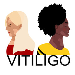 World vitiligo day.Young women different ethnicities with skin disease. Depigmentation problem. Patchy loss of derma color.Autoimmune sickness. Vector illustration for medical holiday.Body positive.