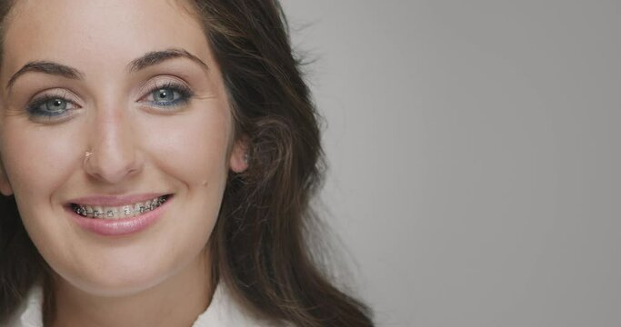 Teeth alignment by braces. Young female smiling friendly. Dental care, orthodontic treatment. Copyspace for advertising