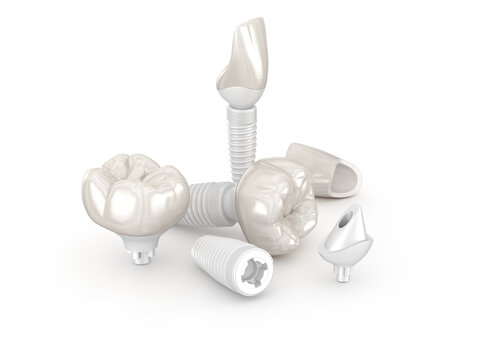 Ceramic crown, implant abutment and implantat. Medically accurate 3D illustration of dental implantation