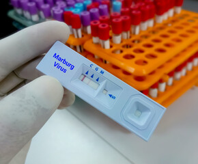 Marburg virus IgG positive result by using rapid test cassette