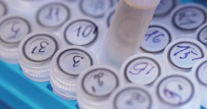 Close-up, the scientist puts the missing test tube in a rack with small test tubes, slow motion on the slide along the test tubes.