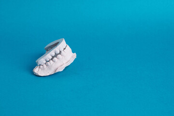 Study model dental impression teeth on blue background © ZaizStudio