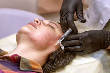 Doctor cosmetologist makes an injection into a woman's face. Biorevitalization procedure