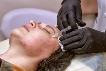 Doctor cosmetologist makes an injection into a woman's face. Biorevitalization procedure