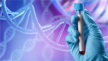 Scient classic DNA structure illustration and doctor hand hold a sample