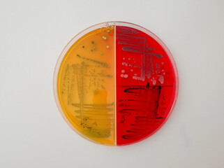 laboratory dish contain growth of colored bacterial colonies on differential agar media