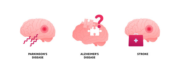 Brain disease concept. Vector flat illustration set. Parkinson, alzheimer and stroke attack illness icon. Health care neurology medical sign. Design element.