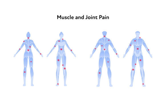 Muscle and joint pain infographic. Vector flat illustration set. Man and woman standing blue skinless silhouette with red ache dot. Front and back view. Design element for health care.
