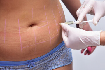 Beauty injections in the salon. The procedure for skin tightening and rejuvenation. Reduced body fat. Figure modeling.