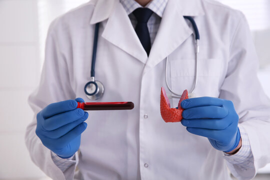 Doctor holding thyroid gland model and blood sample indoors, closeup