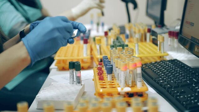 Many medical test tubes with blood tests on the table in the laboratory. The healthcare professional prints and signs labels for test tubes