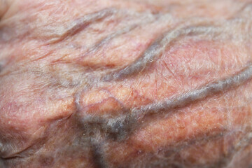 Close up of skin of hand of old 90 year old woman grandmother.