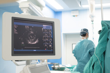 Doctor is examining heart's patient by echocardiogram for diagnosis disease or explain symptom....