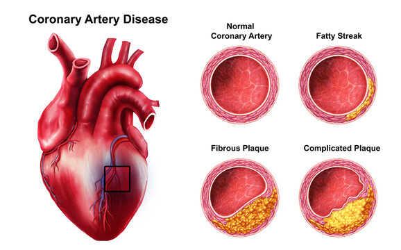  Medical illustration of human Heart anatomy