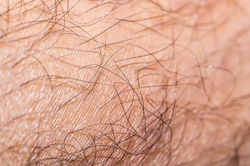 Very detailed close-up at human skin, covered with skin hair.