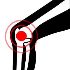 Vector symbol of knee joint bones with paint for orthopedic purposes.