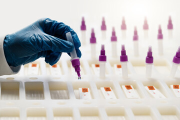 corona schnelltest, covid test