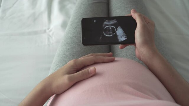 Happy Asian Pregnant woman looking ultrasound image on smartphone while touching her belly. Baby development, Concept of pregnancy, Maternity prenatal care. Mom with a new life