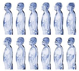 Complete real MRI scan the upper part of the human body