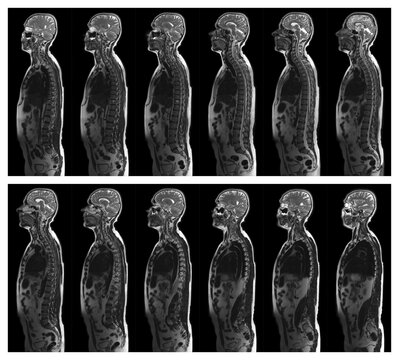Complete real MRI scan the upper part of the human body
