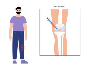 Fototapeta premium Knee Injection and treatment