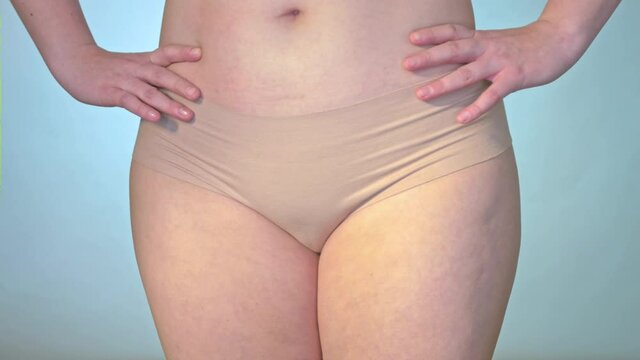 Obesty woman's hips. She is turning around and showing fat and cellulite on her body to camera. She need to loss weight. Slowmotion video.