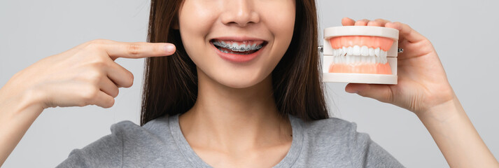 Smiling Asian woman wearing braces showing pointing finger and holding tooth model on grey background, Concept oral hygiene and health care. proportion of the banner for ads.