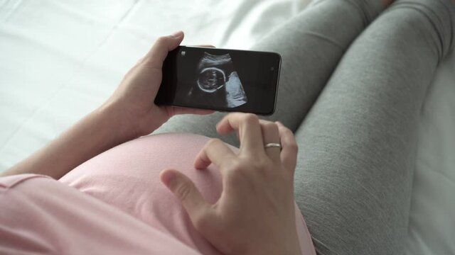 Happy Asian Pregnant woman looking ultrasound image on smartphone while her playing belly. Baby development, Concept of pregnancy, Maternity prenatal care. Mom with a new life